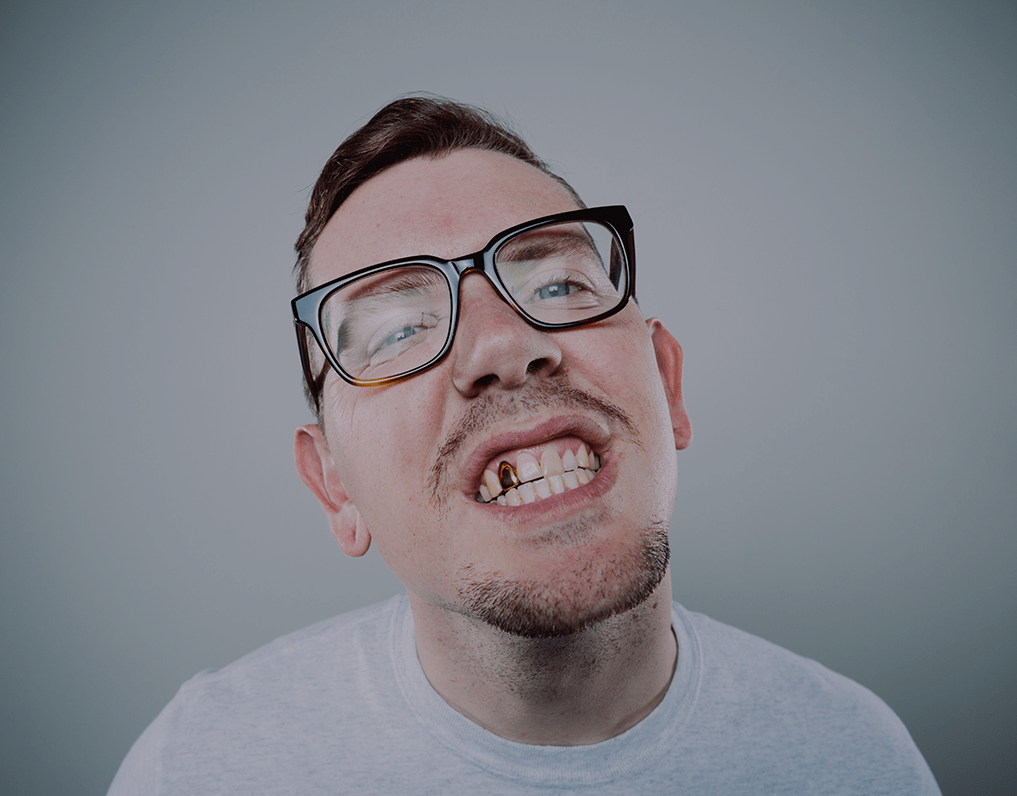 Gold Dental Crown: Cost, Facts, Pros & Cons (2023 Guide) – NatruSmile