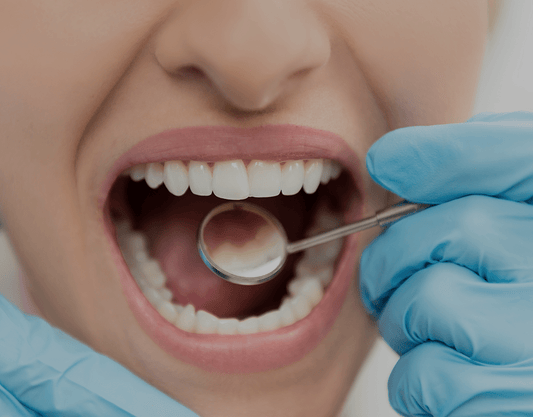 How Many Teeth Do Adults Have?