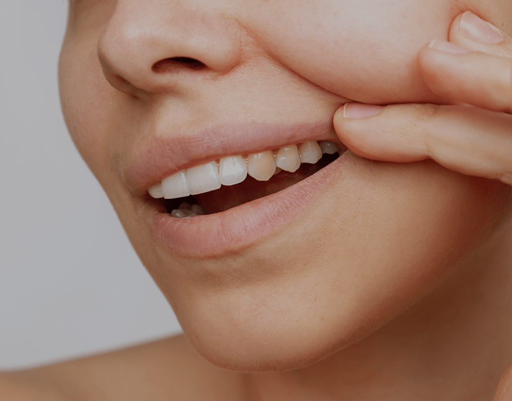 How To Fix Uneven Teeth Whitening (2023 Guide) NatruSmile