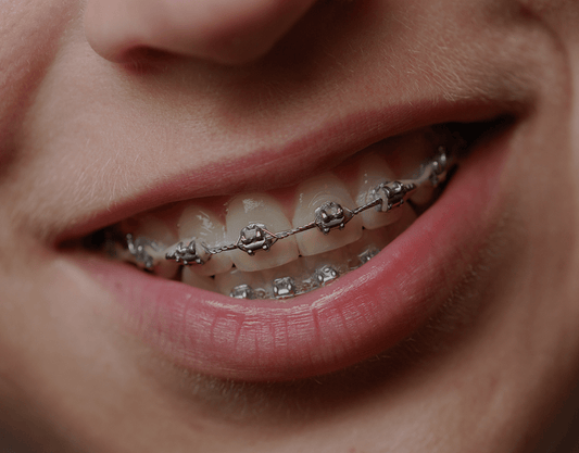 How To Use Dental Wax - Do's And Don'ts