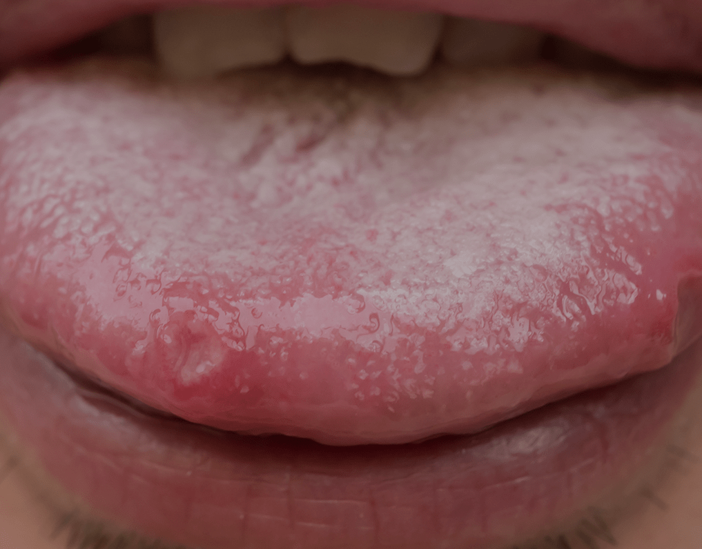 chewing tobacco manufacturers the truth about smokeless tobacco chewing tobacco manufacturers the truth about smokeless tobacco