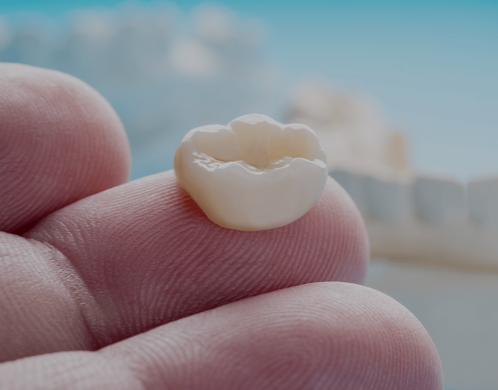 Temporary Crowns: Uses, Procedure, And Cost (2023) – NatruSmile