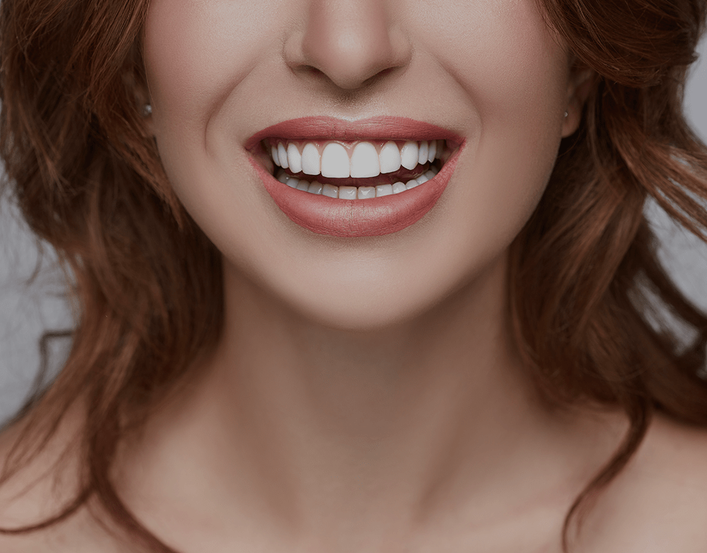 Can You Get Veneers With Receding Gums? (2023 Guide) NatruSmile
