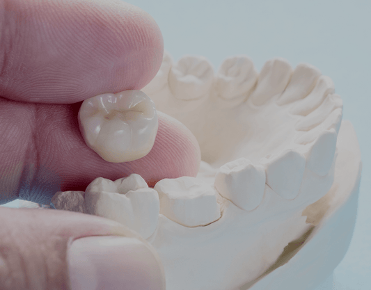 Cost Of Dental Crowns With & Without Insurance