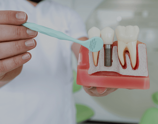 Cost of Dental Implants: Complete Guide