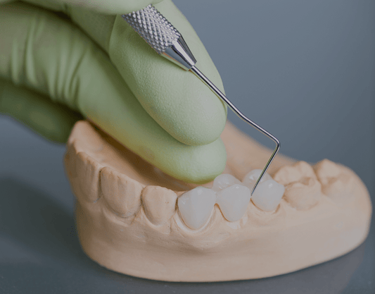 Dental Implants vs. Bridges: Which Is Right For You?