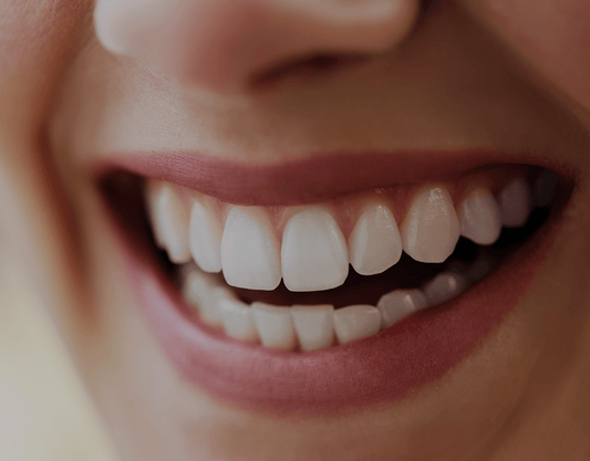 Does Teeth Whitening Damage Your Teeth?