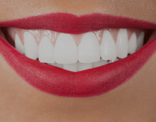 How Much Does Dental Bonding Cost?