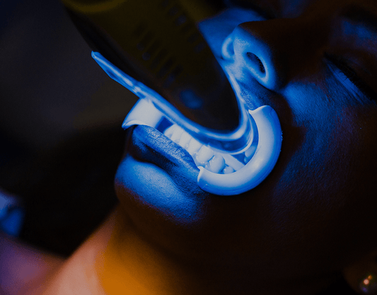 How Much Does Laser Teeth Whitening Cost?