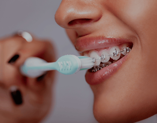 How to Clean Teeth With Braces