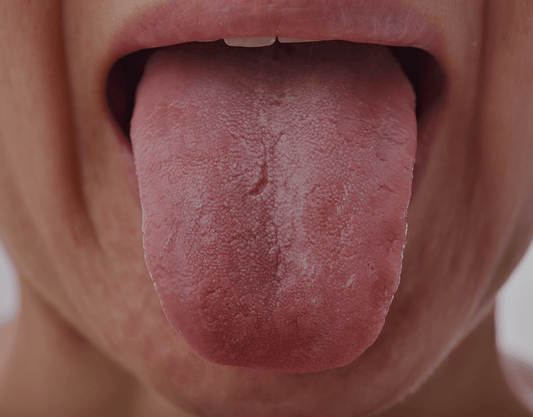 Numb or Tingling Tongue: What Causes Tongue Tingling (and How to Find Relief)