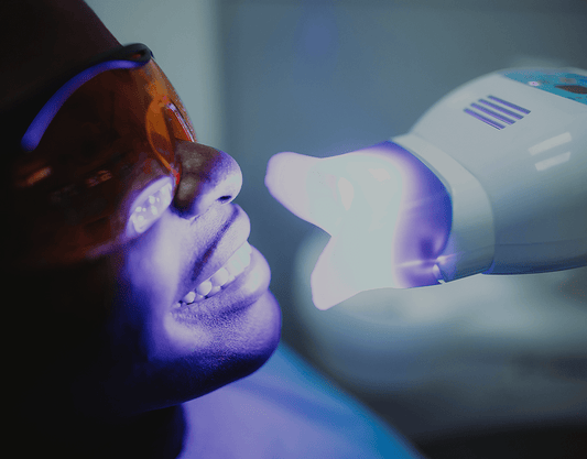 Professional Teeth Whitening Guide