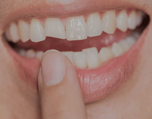 Best Methods To Repair a Broken Tooth
