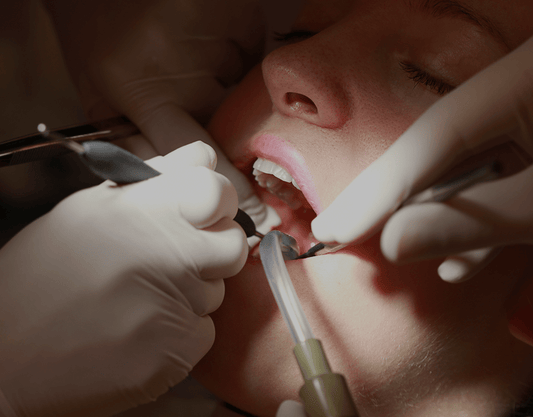 Root Canal Vs. Extraction: Which Is Right For You?