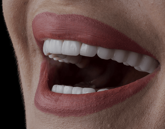 Teeth Whitening vs. Veneers: Which is Right for You?