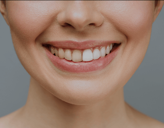 Teeth Yellow After Whitening: Causes And Tips To Prevent