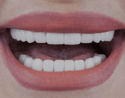 Veneers vs Crowns: What's the Difference?