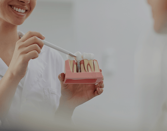A Guide to Dental Implants