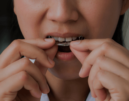 moldable mouth tray crooked teeth｜TikTok Search
