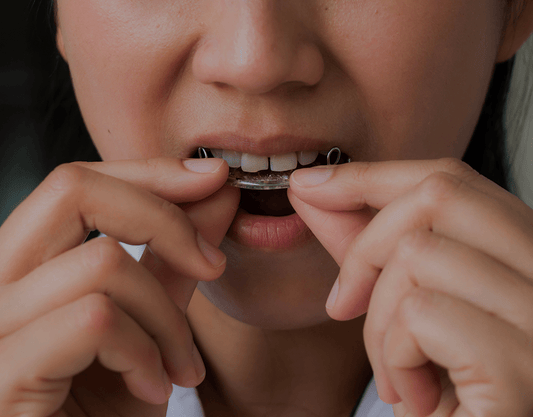 moldable mouth tray crooked teeth｜TikTok Search