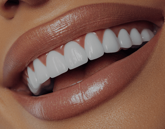 What Do Celebrities Use To Get Their Teeth So White?