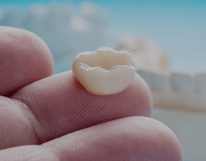 Temporary Crowns Uses, Procedure, And Cost (2023) NatruSmile