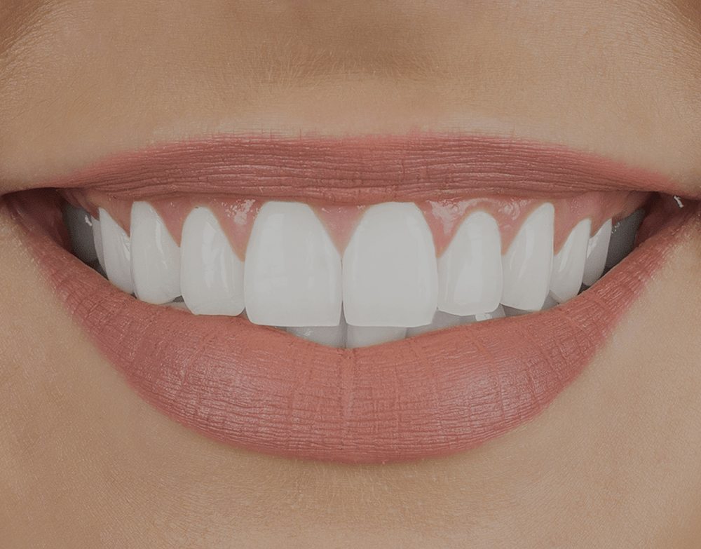 6 Tips To Whiten Teeth With Minimal Damage NatruSmile
