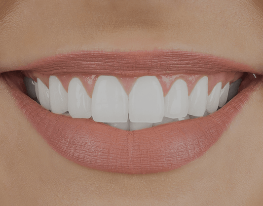 Tips to Whiten Teeth With Minimal Damage